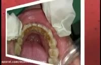 کلینیک دندانپزشکی تاج | دندانپزشکی کودکان | ایمپلنت