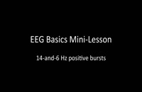 EEG Basic 014
