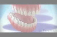 کامپوزیت ونیر در بهترین نقطه تهران – کلینیک  دندانپزشکی تاج