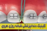 استفاده از نخ دندان بعد از ارتودنسی دندان ها
