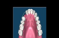 ارتودنسی دندان | کلینیک دندانپزشکی تاج