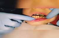 ارتودنسی دندان در بهترین نقطه تهران – کلینیک  دندانپزشکی تاج