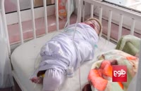 پزشکان: بستن نوزاد جلو رشد او را می‌گیرد