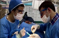 کاشت ایمپلنت سریع با کمک راهنمای جراحی|کلینیک دندانپزشکی مدرن