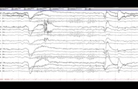 EEG Basic 005