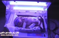 اجاره دستگاه درمان زردی نوزاد